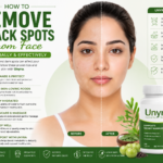 How to remove black spots from face